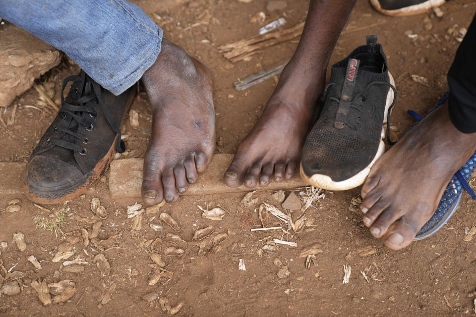 Street vendors take off their shoes to show their toes on the streets of Harare, Zimbabwe, Thursday, June, 9, 2022. Rampant inflation is making it increasingly difficult for people in Zimbabwe to make ends meet. Since the start of Russia’s war in Ukraine, official statistics show that Zimbabwe’s inflation rate has shot up from 66% to more than 130%. The country's finance minister says the impact of the Ukraine war is heaping problems on the already fragile economy. (AP Photo/Tsvangirayi Mukwazhi)