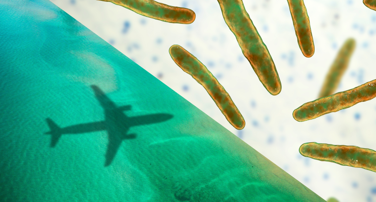 Leprosy is on the rise in Florida — are Canadian travellers at risk? split screen of airplane over ocean and close up of leprosy bacteria