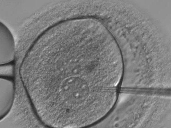 An embryo is injected with the Crispr/Cas9 gene-editing components: Dr Kathy Niakan/Nature