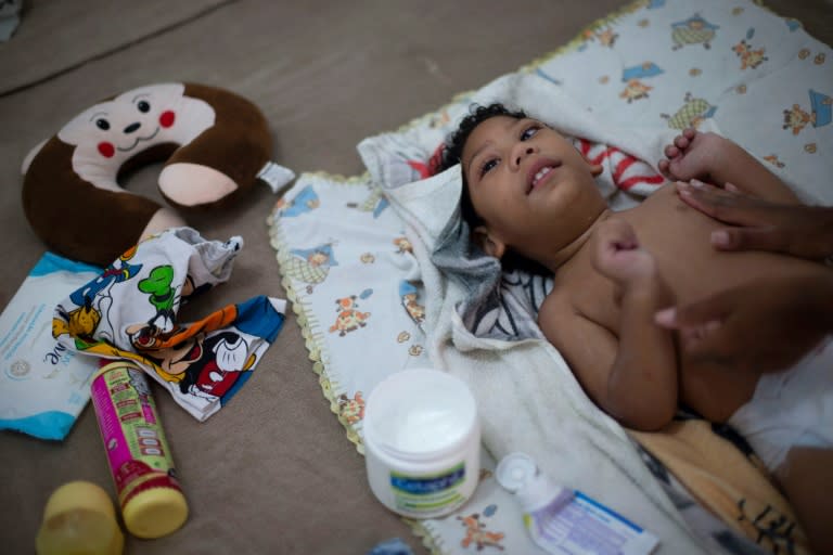 Brazilian Thamires Ferreira da Silva, 29, changes her two-year-old son Matheus, who was born with microcephaly