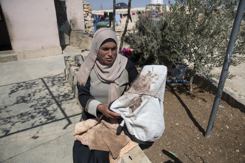 Palestinian mother Baraa Hamamdi holds her injured son's bloodstained clothes that was left behind after Mohammed was evacuated to an Israeli hospital, following a settlers attack from nearby settlement outposts on her Palestinian Bedouin community, in the West Bank village of al-Mufagara, near Hebron, Thursday, Sept. 30, 2021. (AP Photo/Nasser Nasser)