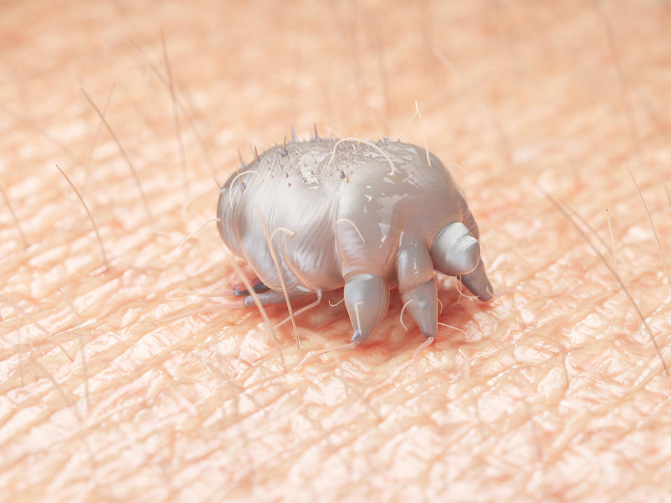 Illustration of a scabies mite on human skin.
