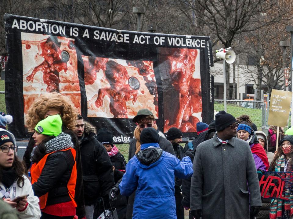 'Abortion is a savage act of violence'