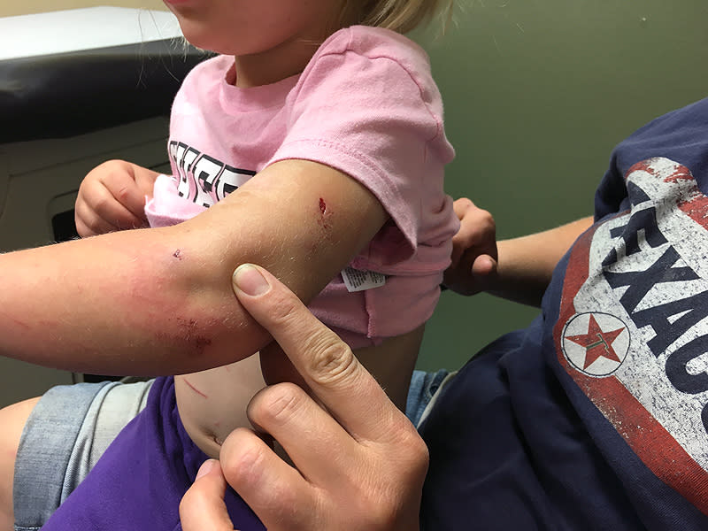 4-Year-Old Girl Survives Mountain Lion Attack During Camping Trip: 'He Had My Daughter in His Mouth,' Says Dad| Exotic Animals & Pets, Personal Tragedy, Real People Stories