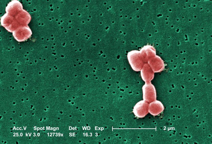 This digitally colorized scanning electron microscopic (SEM) depicts two clusters of Acinetobacter baumannii bacteria