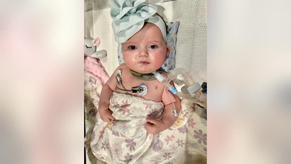 <div>Kylie Overfield, the 5-month-old battling a rare lung disease, is awaiting transplant surgery at Texas Children's after a donor was found (Family photo)</div>