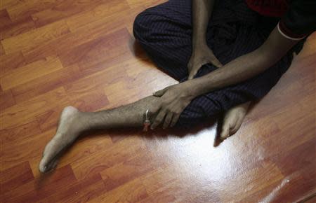 Bozor Mohammed from the Rakhine state in Myanmar speaks to a reporter about his leg being injured during an interview at his house in Kuala Lumpur November 8, 2013. REUTERS/Samsul Said
