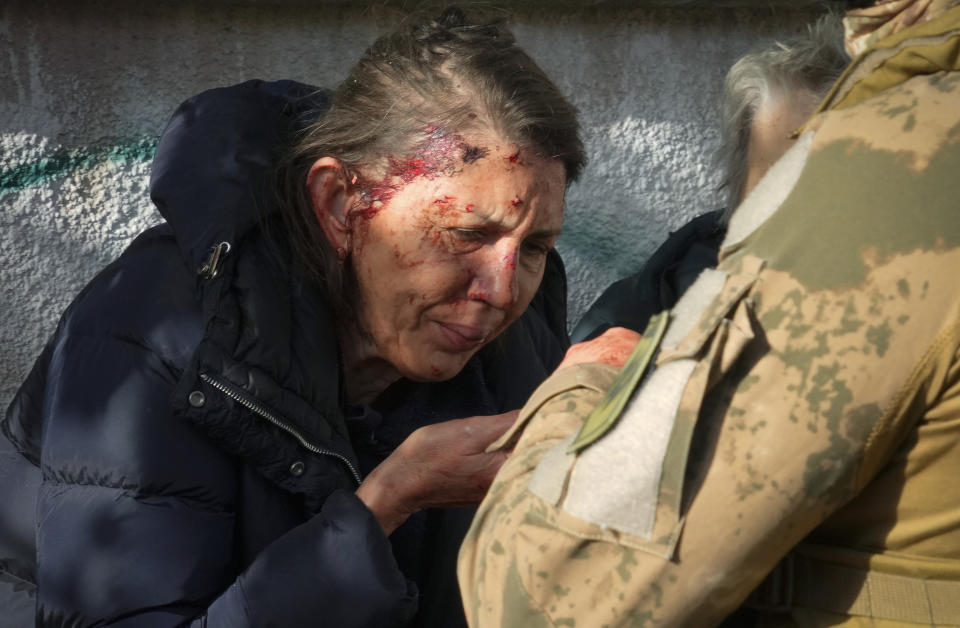 An injured woman reacts after Russian shelling in Kyiv, Ukraine, Monday, Oct. 10, 2022. Two explosions rocked Kyiv early Monday following months of relative calm in the Ukrainian capital. (AP Photo/Efrem Lukatsky)