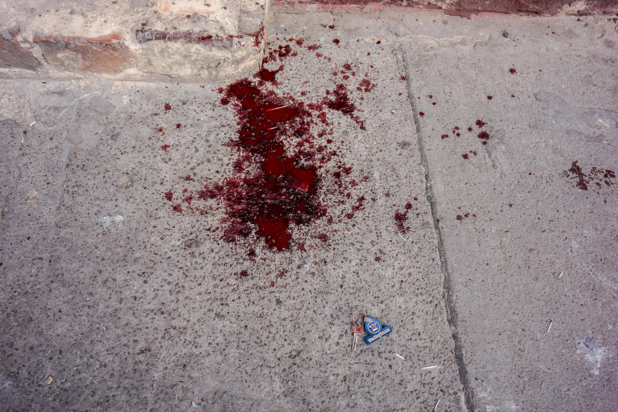 BOGOTA, COLOMBIA - JULY 11, 2014:   Crime Scene. Blood on the streets of Bogota. Bogota has traditionally enjoyed lower homicide rates than other major cities in Colombia. However, street crime in the capital is among the country’s highest.  PHOTO BY GILES CLARKE/GETTY IMAGES