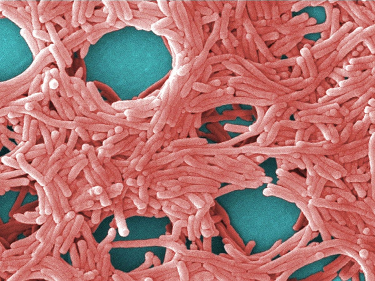 Legionella bacteria was responsible for the outbreak  (Public domain)