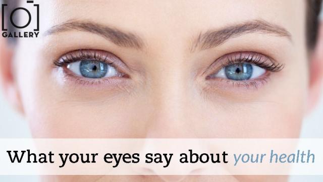 What your eye colour says about your health