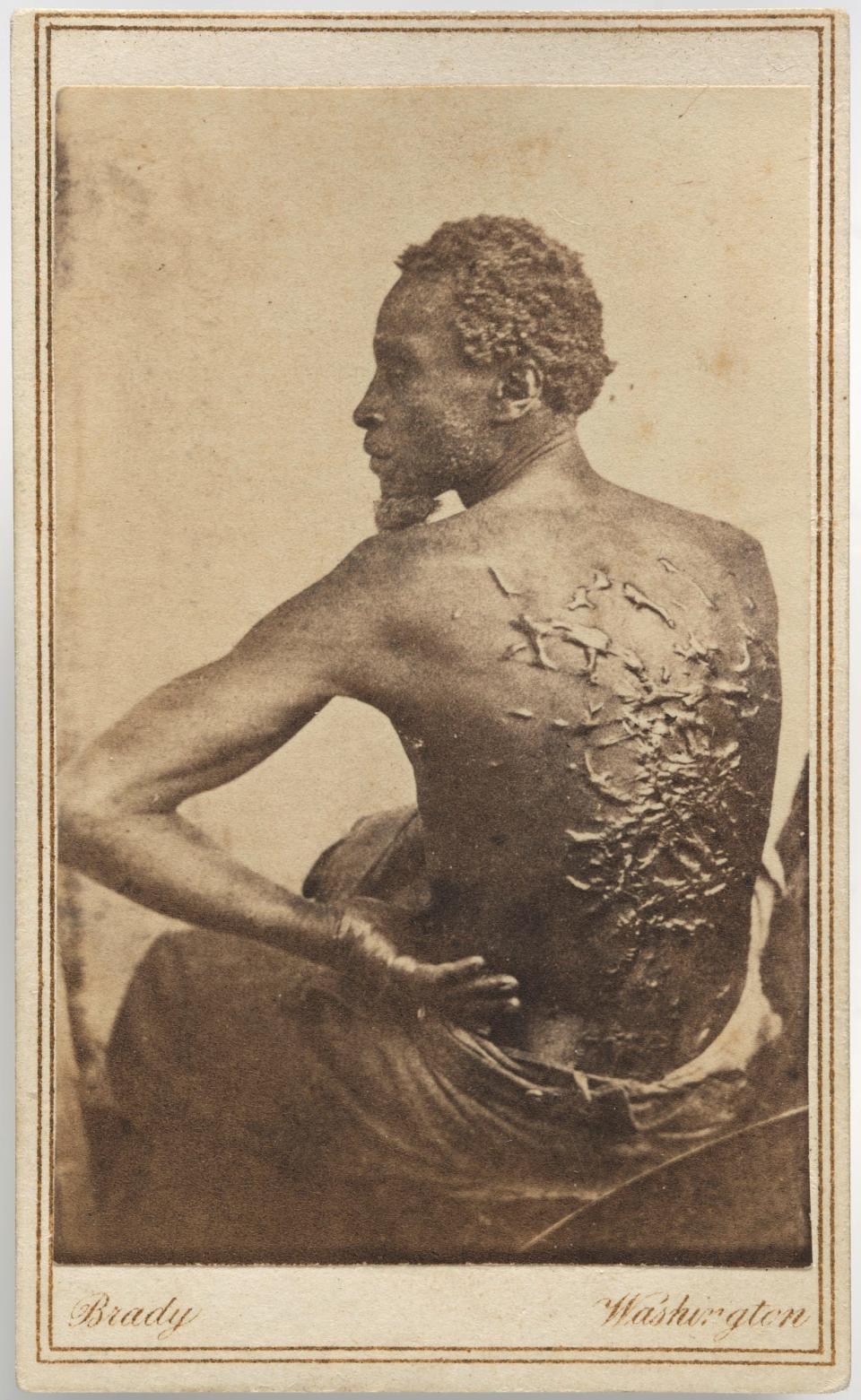 "The Scourged Back" photograph taken by William McPherson with Mr Oliver of "Peter." Baton Rouge, Louisiana. 1863.