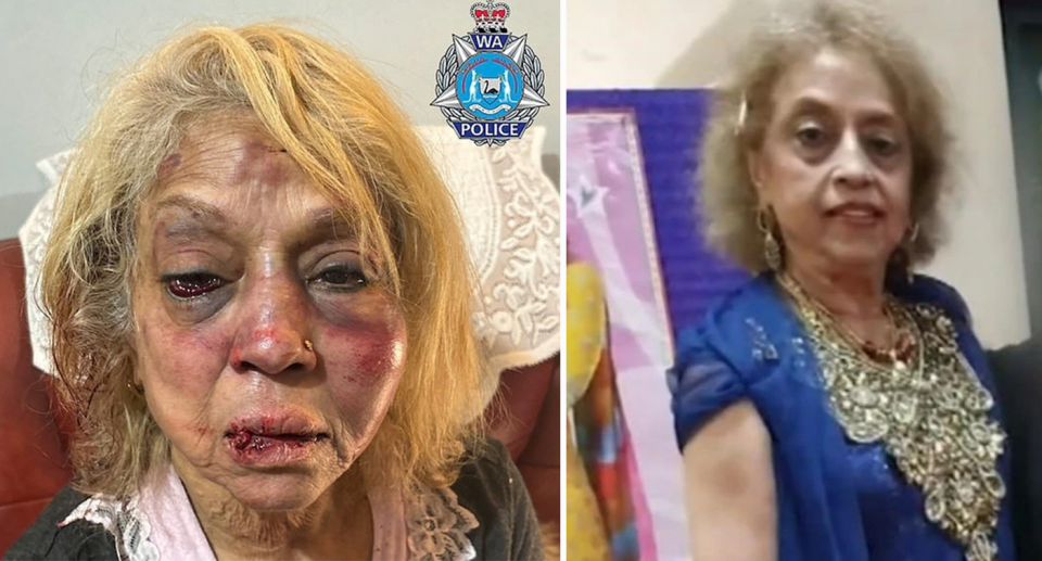 Perth grandmother is pictured left showing a badly bruised and cut face. Right is a photo of her prior to the attack. 