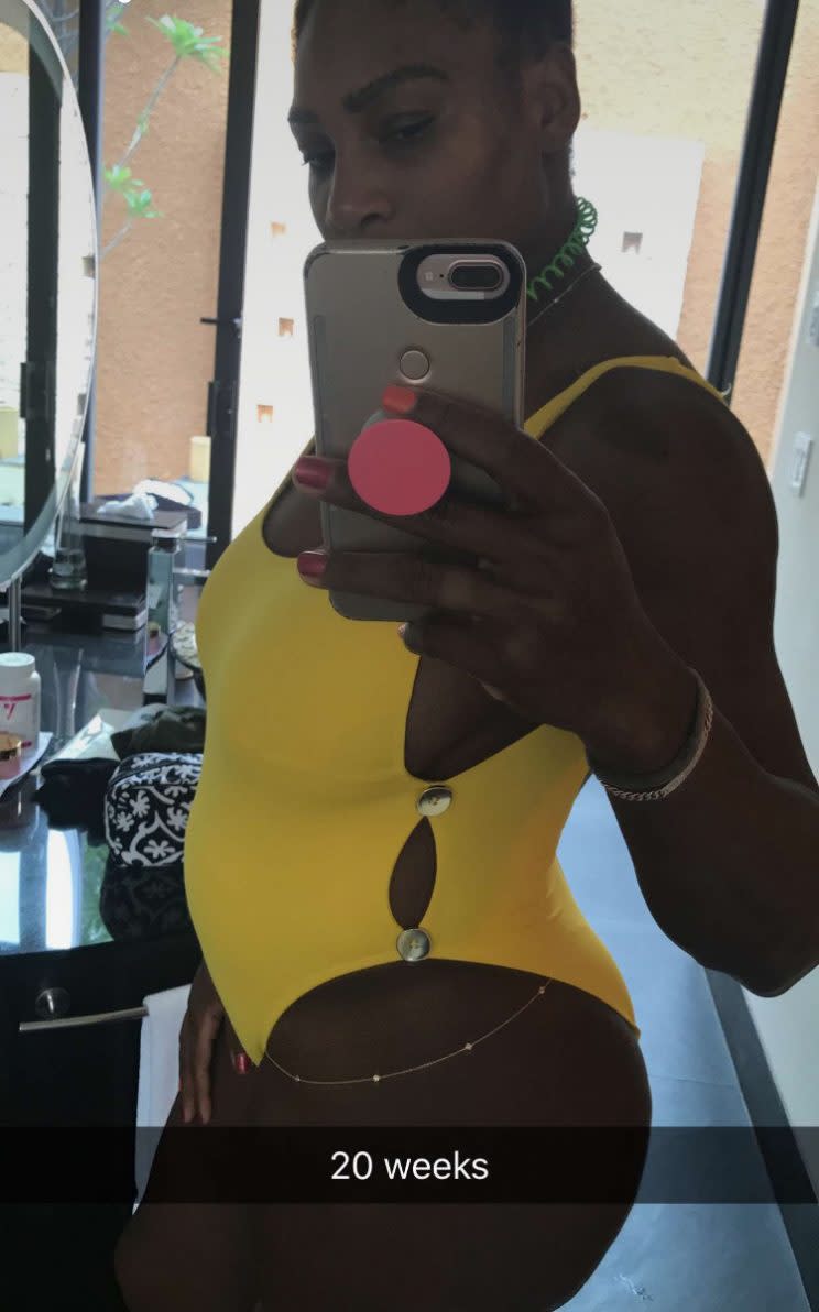 Serena Williams ist schwanger