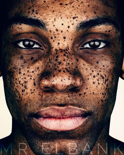 Elbank is interested in capturing uniquely freckled faces of all ages and skin tones