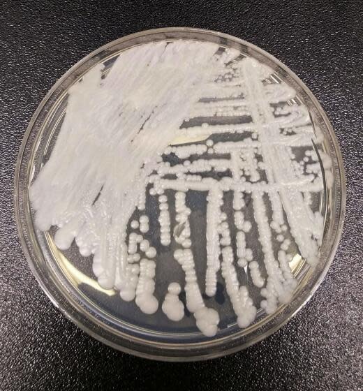 FILE - This undated photo made available by the Centers for Disease Control and Prevention shows a strain of Candida auris cultured in a petri dish at a CDC laboratory. Southern Nevada has emerged as the place in the U.S. with the highest number of cases of the potentially lethal fungus that is resistant to common antibiotics and can be a deadly risk to hospital and nursing home patients. (Shawn Lockhart/Centers for Disease Control and Prevention via AP, File)