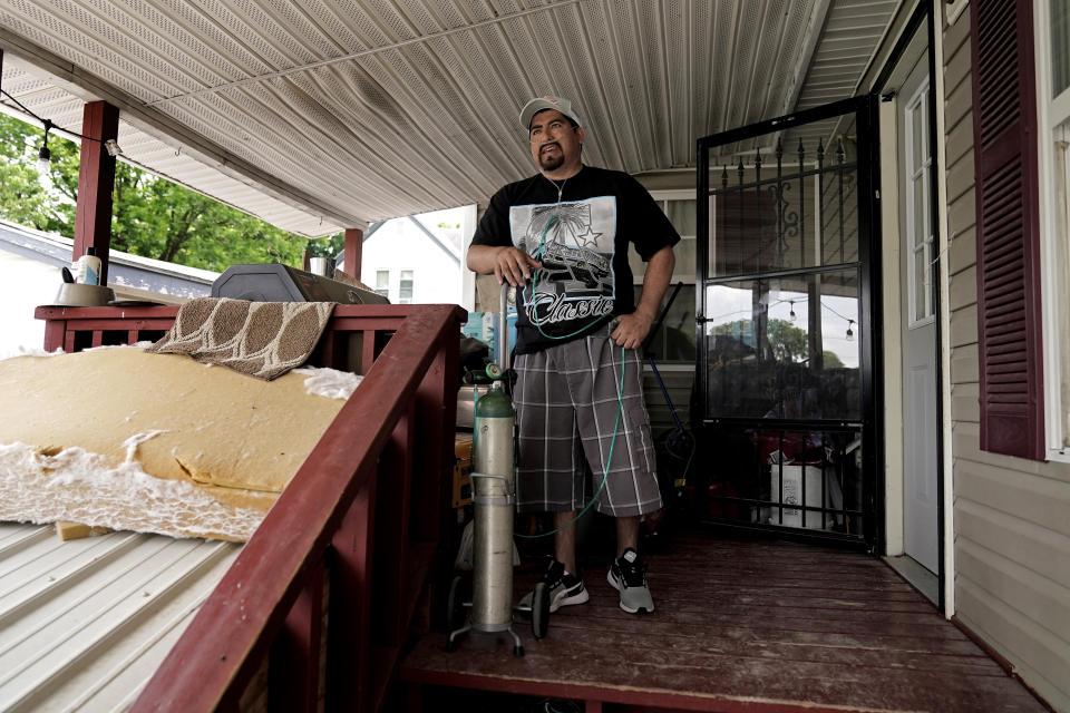 Freddy Fernandez rests on the porch of his home after taking a short walk Friday, June 10, 2022, in Carthage, Mo. After contracting COVID-19 in August 2021, Fernandez spent months hooked up to a respirator and an ECMO machine before coming home in February 2022 to begin his long recovery from the disease. (AP Photo/Charlie Riedel)