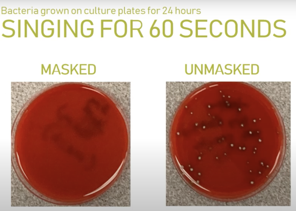 Wearing a mask while singing was shown to dramatically reduce the bacteria spread. Source: Microbiology Lab at Providence Sacred Heart Medical Center & Children's Hospital