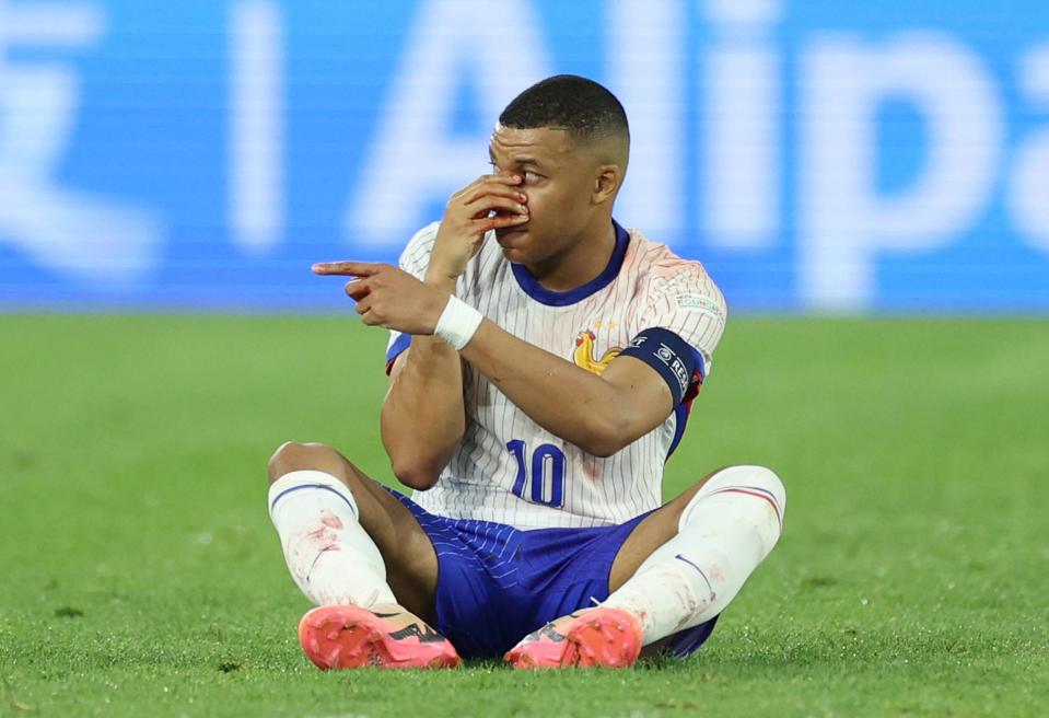 French players and football federation hopeful Mbappe can play through broken nose