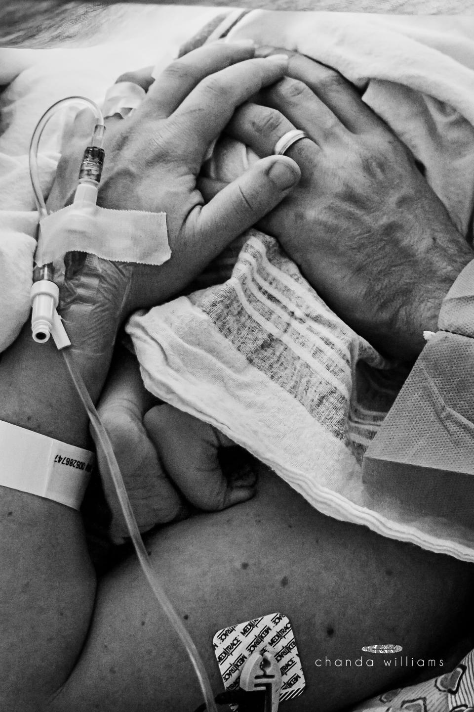 "This is one of my favorite cesarean images. It reminds me of the resilience of partnership, and the need to adapt together."