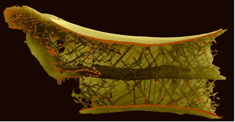 A computer-generated image of the cross-section of a pterosaur vertebra, showing the spokes in a helix pattern.