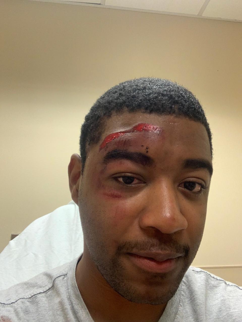Nahshon Bain-Greenidge, 29, a shift manager with Starbucks in West Knoxville said he was violently arrested by Knox County Sheriff's officers while on duty Oct.21