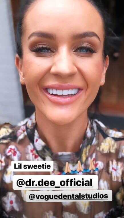 Ines Basic from MAFS gets her teeth done