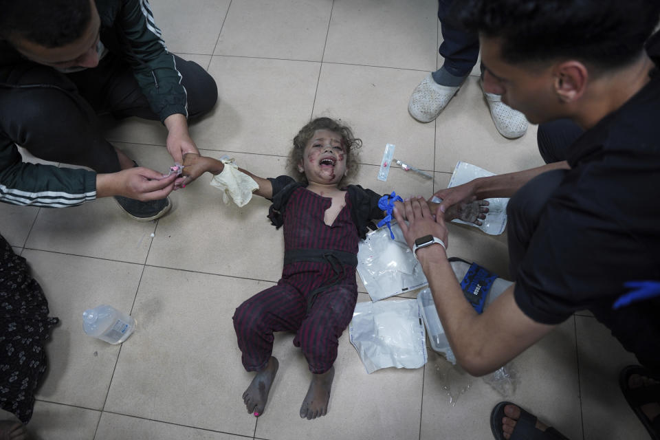 Palestinian medics treat a wounded baby in the Israeli bombardment of the Gaza Strip at Al Aqsa Hospital in Deir al Balah, Gaza Strip, on Saturday, May 11, 2024. (AP Photo/Saher Alghorra)