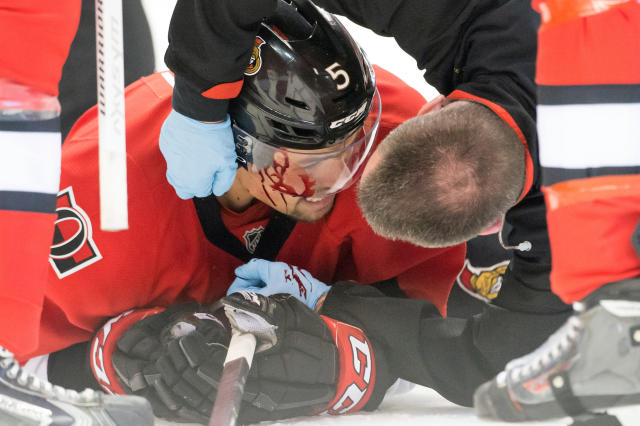 Cody Ceci bloodied after taking puck to the head (GIF)