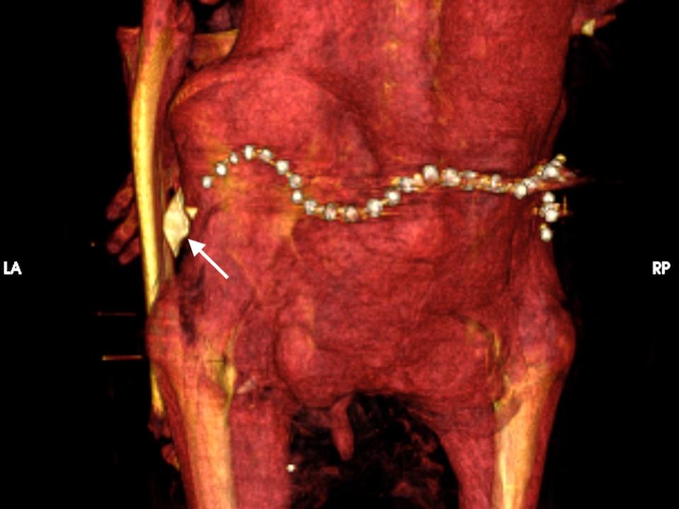 A scan of Amenhotep's body shows a beaded girdle and an amulet.