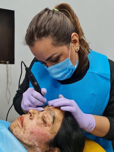 Dr Shikha has worked with about a dozen acid attack and burn victims so far - each of them had a unique set of scars and each time it was a different approach.