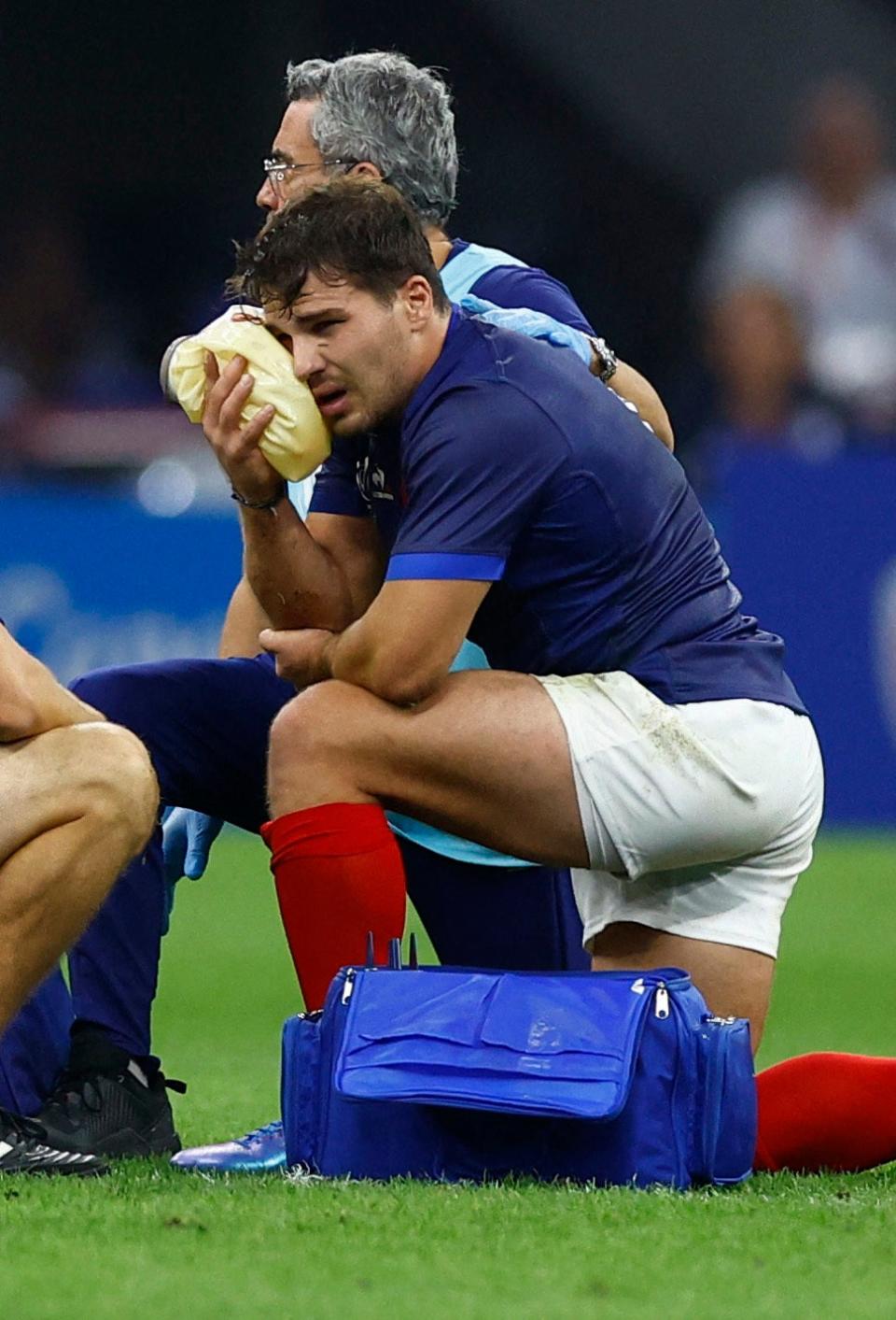 France’s Antoine Dupont receives treatment after taking a knock to the head (REUTERS)