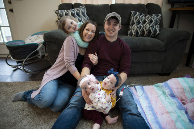 Here's What Conjoined Twins Abby and Brittany Are Up To