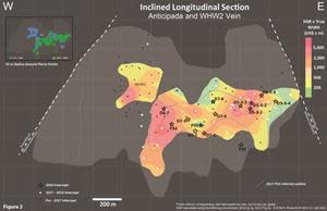 Inclined Longitudinal Section Anticipada and WHW2 Vein