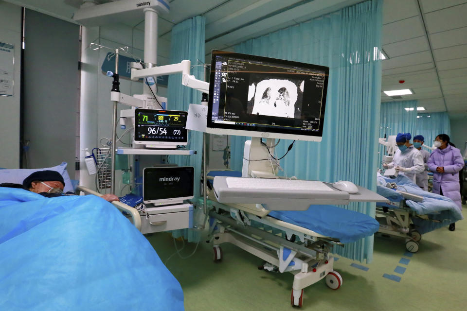 FILE - A patient lies on a bed near a screen showing a scan of the lungs in the ICU ward of a hospital in Suining in southwestern China's Sichuan province, Dec. 31, 2022. China's sudden reopening after two years holding to a "zero-COVID" strategy left older people vulnerable and hospitals and pharmacies unprepared during the season when the virus spreads most easily, leading to many avoidable deaths, The Associated Press has found. (Chinatopix Via AP, File)