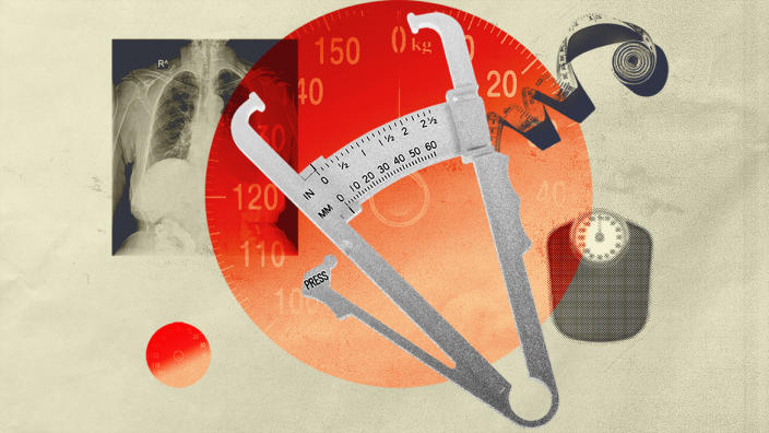 Is BMI a poor way to assess weight and health?