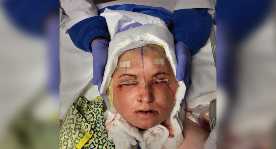 The face transplant (pictured) took place in 2017 at the Cleveland Clinic, the same clinic that performed the United States' first face transplant on Connie Culp in 2008