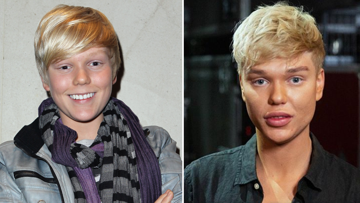 Jack Vidgen in 2011 (L) and 2019 (R). Photo: Getty (L) and Channel Nine (R)