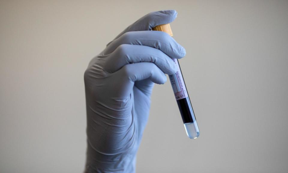 <span>The first phase of Transform will involve about 12,500 men and will assess methods including prostate-specific antigen blood tests.</span><span>Photograph: Simon Dawson/PA</span>