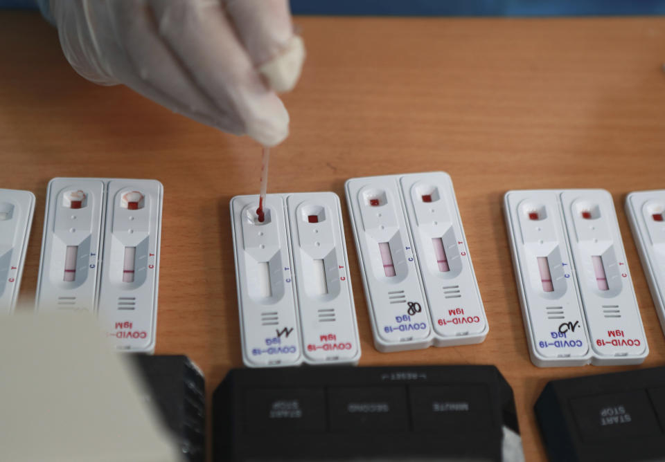 A health worker drops drawn blood on a test kit of COVID-19 in Hanoi, Vietnam, Friday, July 31, 2020. Vietnam reported on Friday the country's first death of a person with the coronavirus as it struggles with a renewed outbreak after 99 days without any cases. (AP Photo/Hau Dinh)