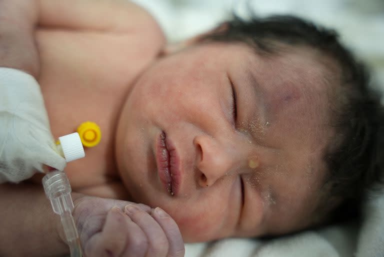 La beba recién nacida que fue encontrado todavía atada por su cordón umbilical a su madre y sacada con vida de los escombros de una casa en el norte de Siria luego de un terremoto mortal, recibe atención médica en una clínica en Afrin, el 7 de febrero