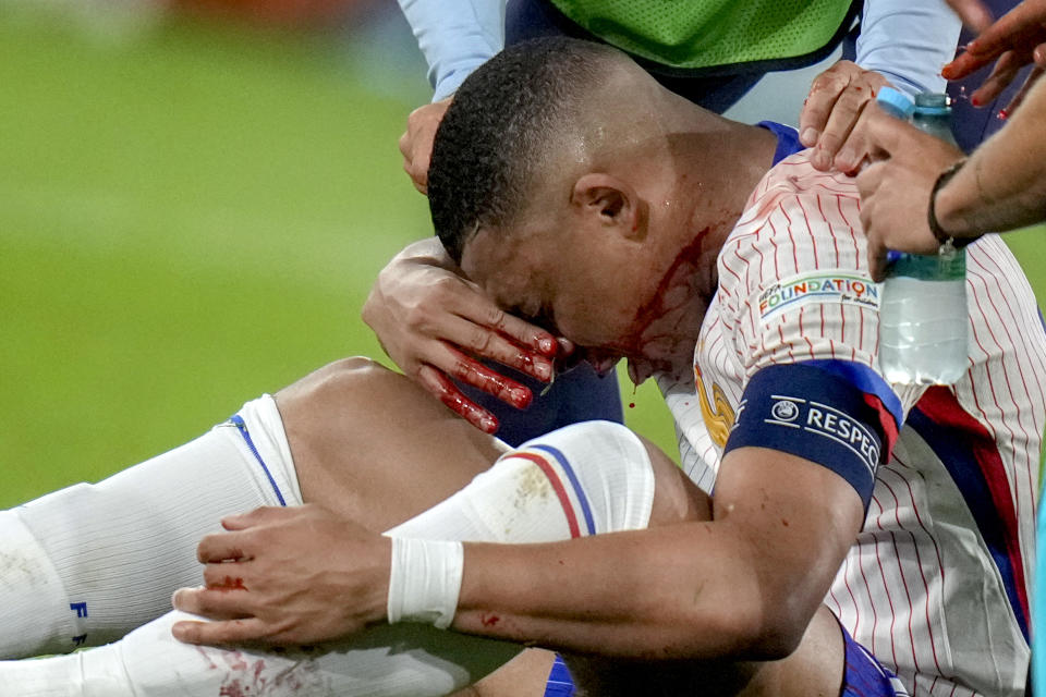 Kylian Mbappe of France receives a treatment after suffering an injury during a Group D match between Austria and France at the Euro 2024 soccer tournament in Duesseldorf, Germany, Monday, June 17, 2024. (AP Photo/Alessandra Tarantino)