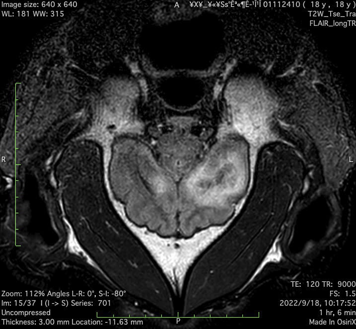 「團團」MRI檢查影像。（圖／台北市立動物園提供） 