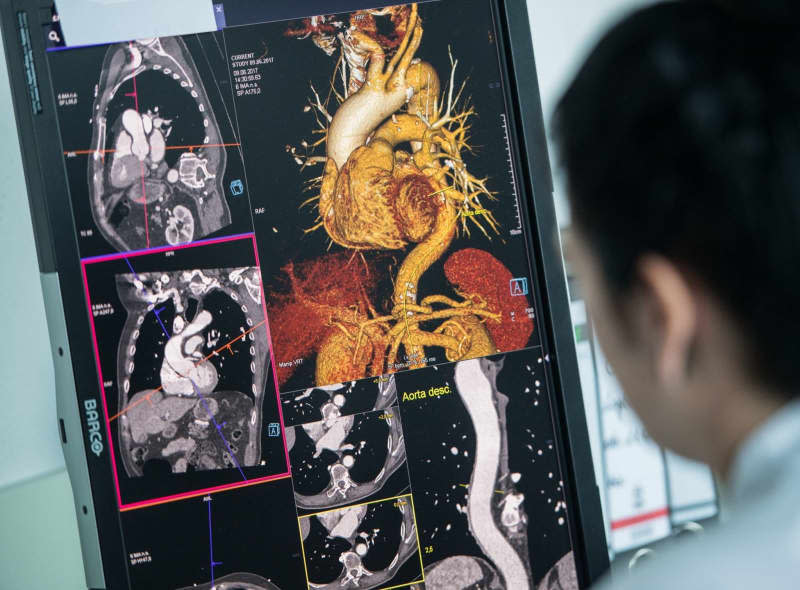 A computer visualization of the aorta, an organ of the body only now officially being recognized as such. Andreas Arnold/dpa