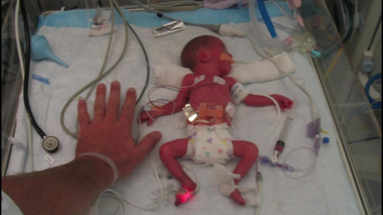 <div>Ryleigh Butz was born three months premature.</div>