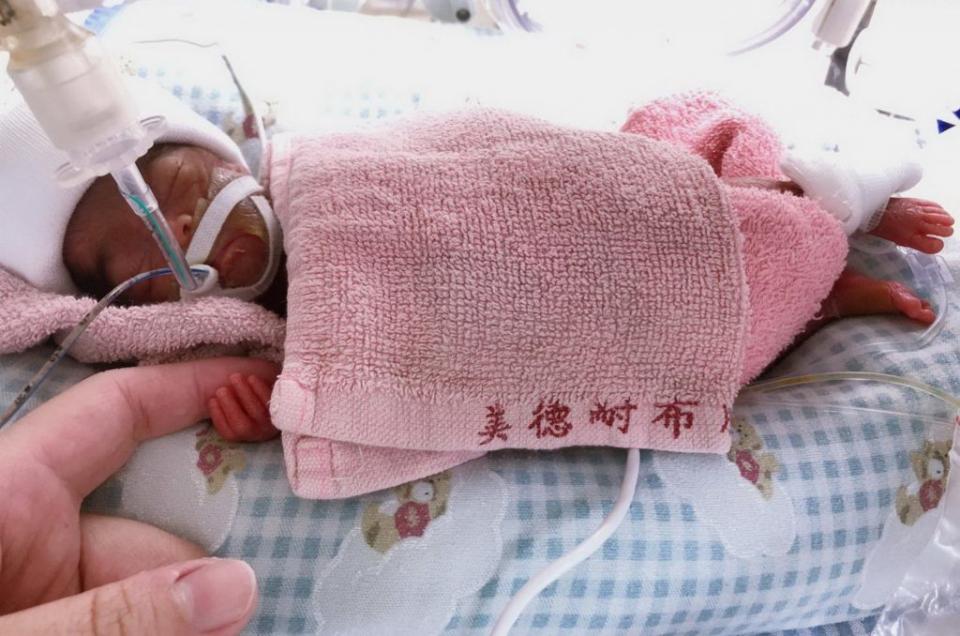 小葶在媽媽肚子138天就出生，體重370克，中山附醫表示，週數最小的巴掌仙子，住院半年，順利出院。（記者陳金龍攝）