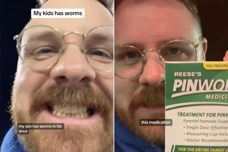 <p>@drumbeatlane/Tiktok</p> Dad reacts to son having worms