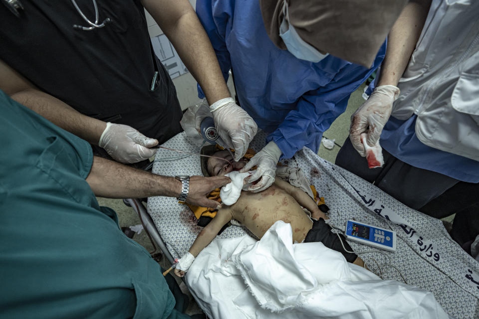 A Palestinian child wounded in the Israeli bombardment of the Gaza Strip is treated in a hospital in Khan Younis, Saturday, Nov. 18, 2023. ( AP Photo/Fatima Shbair)