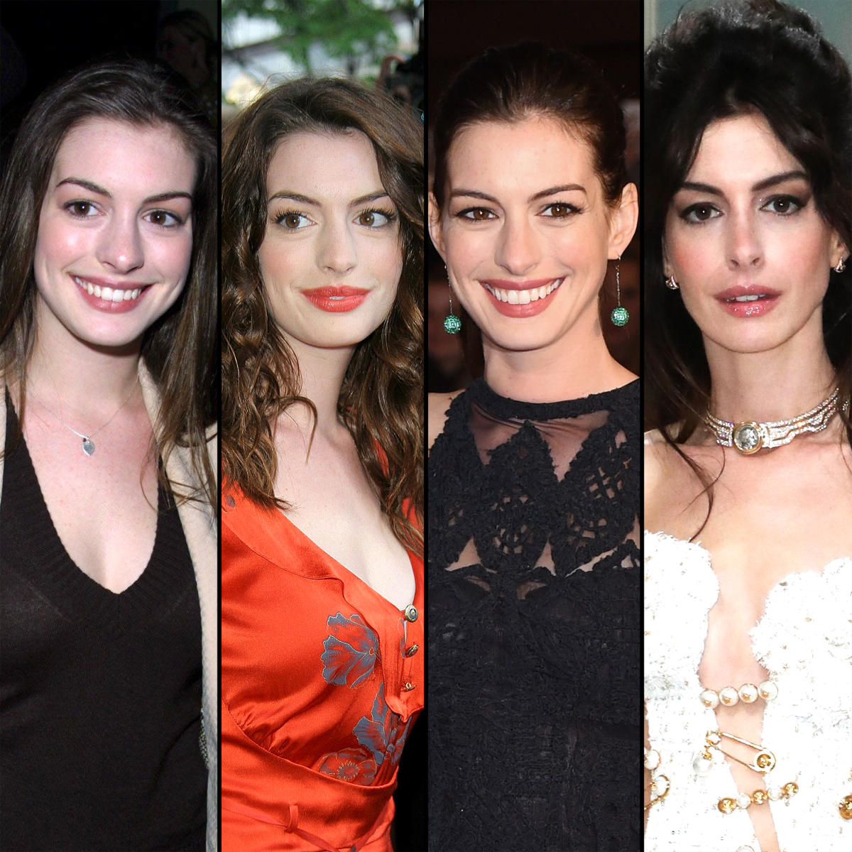 Has Anne Hathaway Undergone Plastic Surgery? See Her Transformation Photos  and Quotes