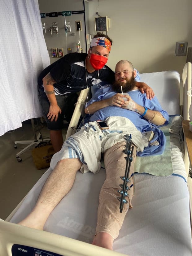 Justin Morissette shares a moment with roommate J.D. Burke after undergoing treatment for a broken leg. Morissette is suing the city and police for allegedly failing to enforce laws against disturbing the peace.